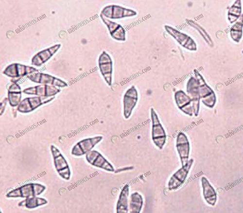 การป้องกันกำจัดโรคข้าวที่เกิดจากเชื้อรา-Pyricularia-grisea-Sacc.